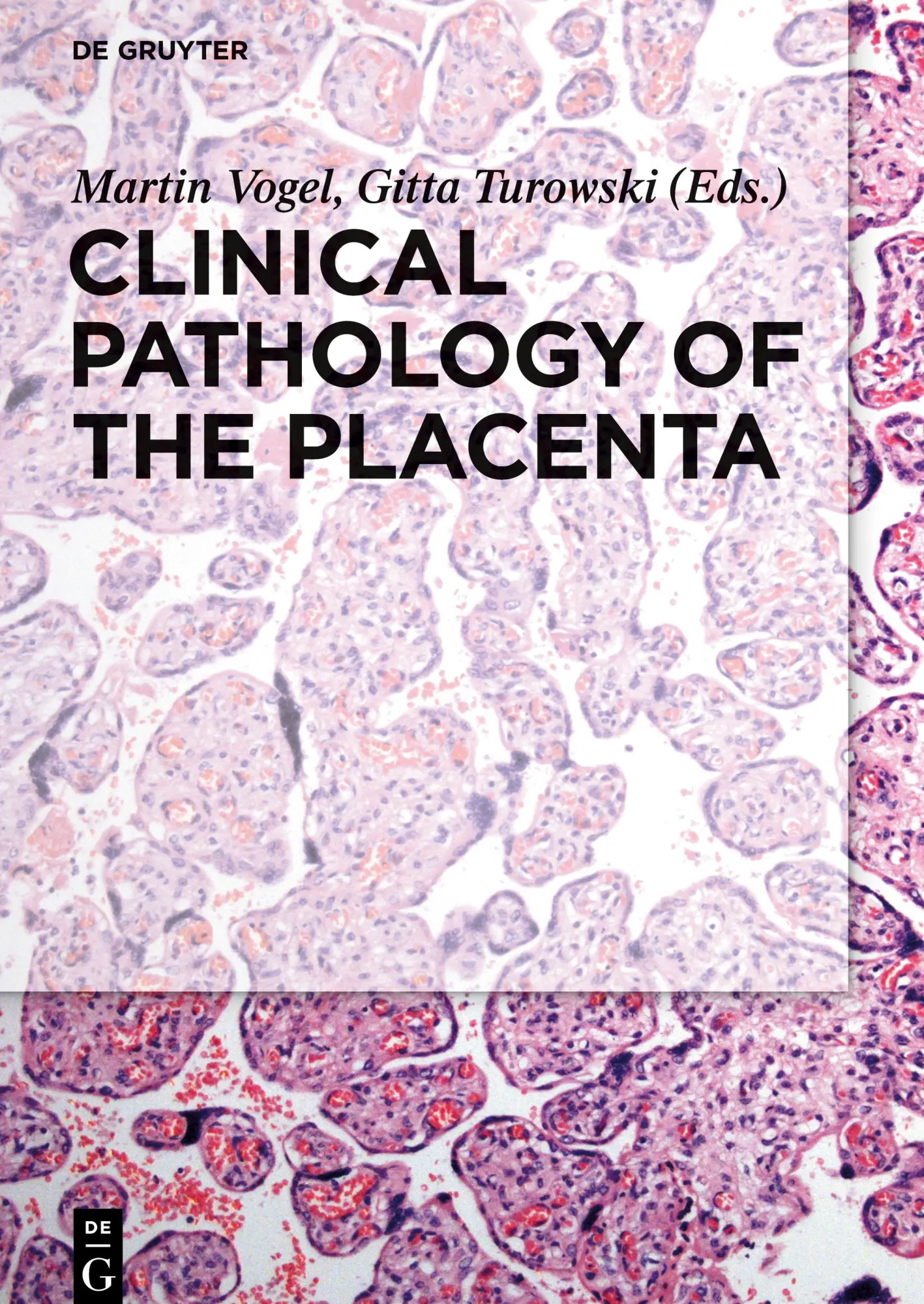 Cover: 9783110449976 | Clinical Pathology of the Placenta | Gitta Turowski (u. a.) | Buch