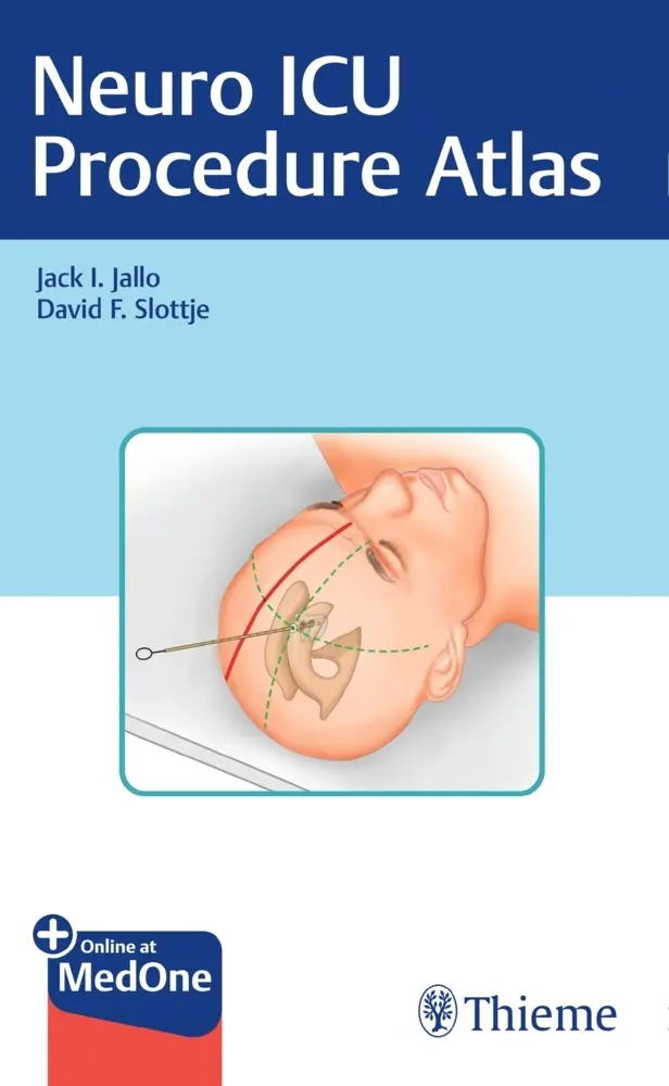 Cover: 9781684200177 | Neuro ICU Procedure Atlas | Including online access | Jallo (u. a.)