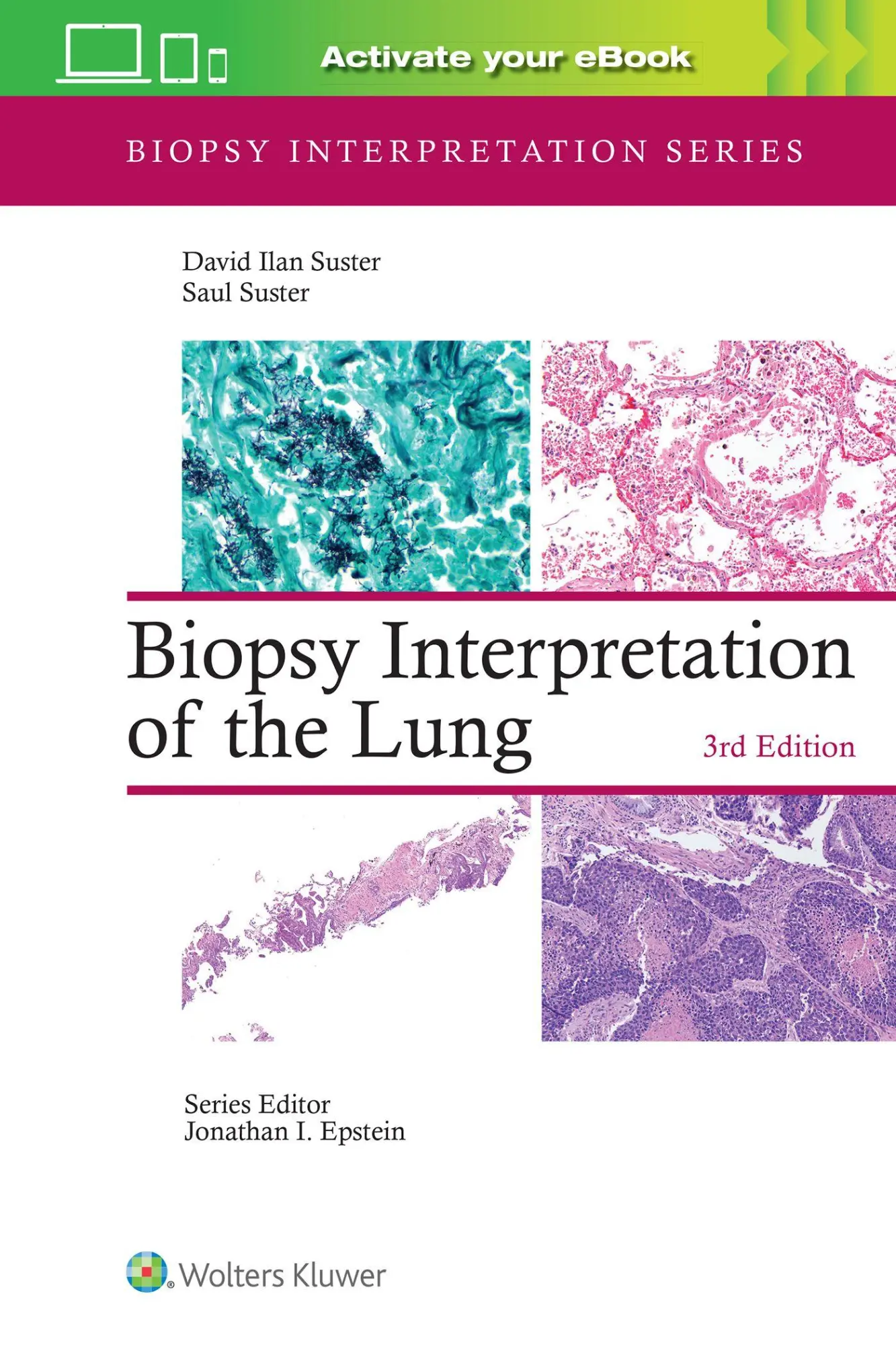 Cover: 9781975240677 | Biopsy Interpretation of the Lung | Print + ebook with Multimedia