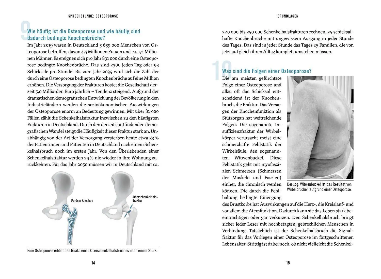 Bild: 9783968590677 | In der Sprechstunde: Osteoporose | Erkennen - verstehen - behandeln