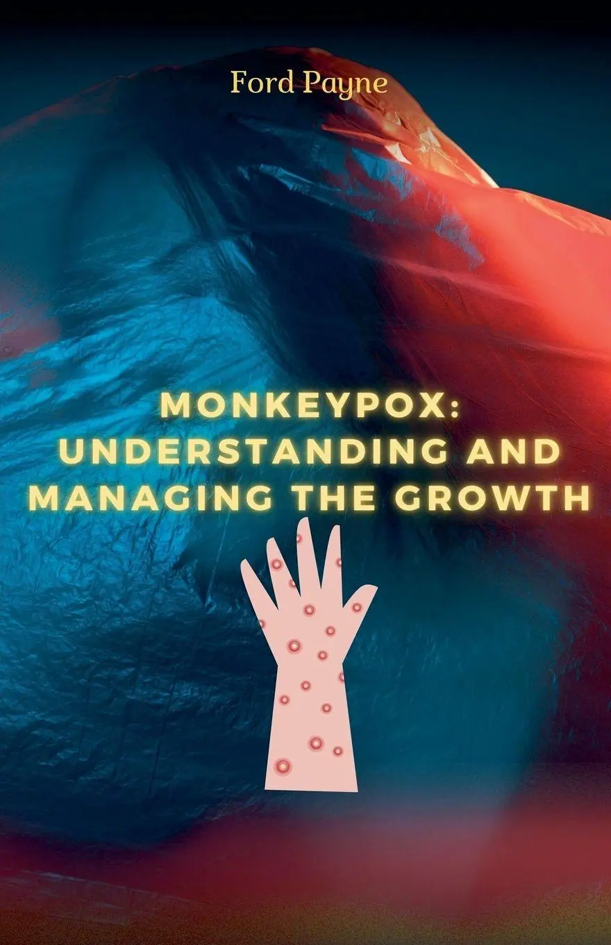 Cover: 9798227531377 | Monkeypox | Understanding And Managing The Growth | Ford Payne | Buch