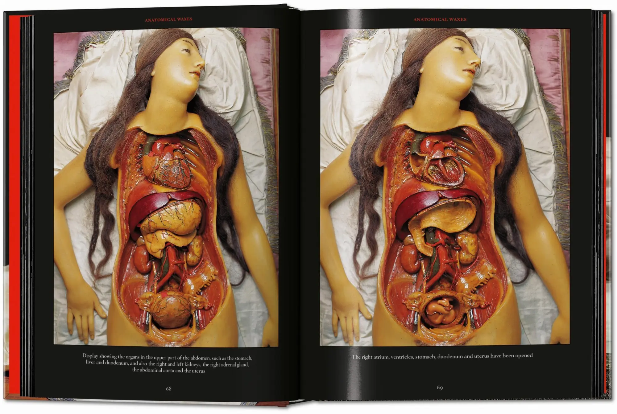 Bild: 9783754402177 | Anatomical Waxes | Marta Poggesi | Buch | 45th Edition | 512 S. | 2025