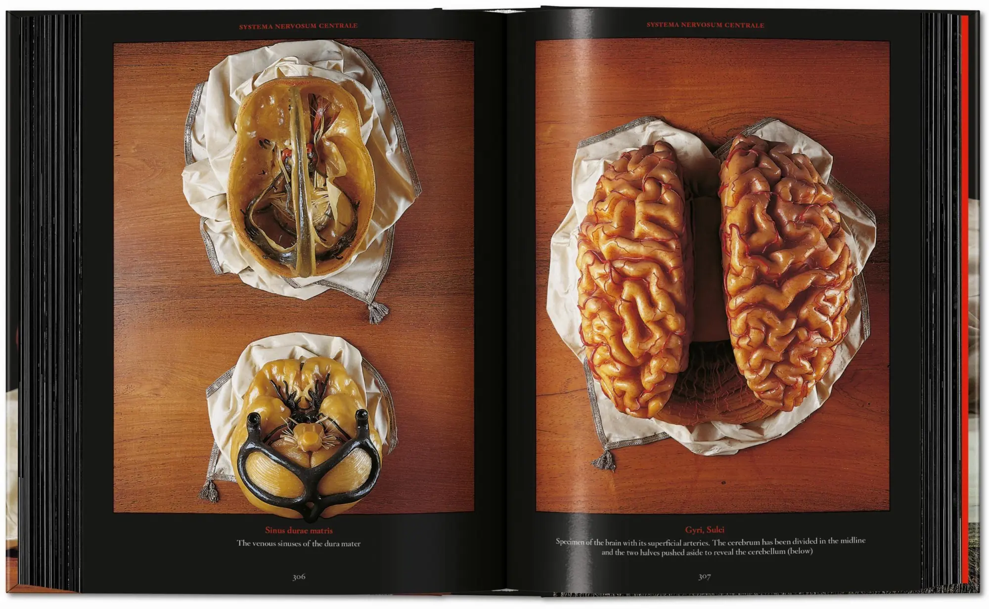 Bild: 9783754402177 | Anatomical Waxes | Marta Poggesi | Buch | 45th Edition | 512 S. | 2025