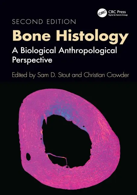 Cover: 9781032473277 | Bone Histology | A Biological Anthropological Perspective | Buch