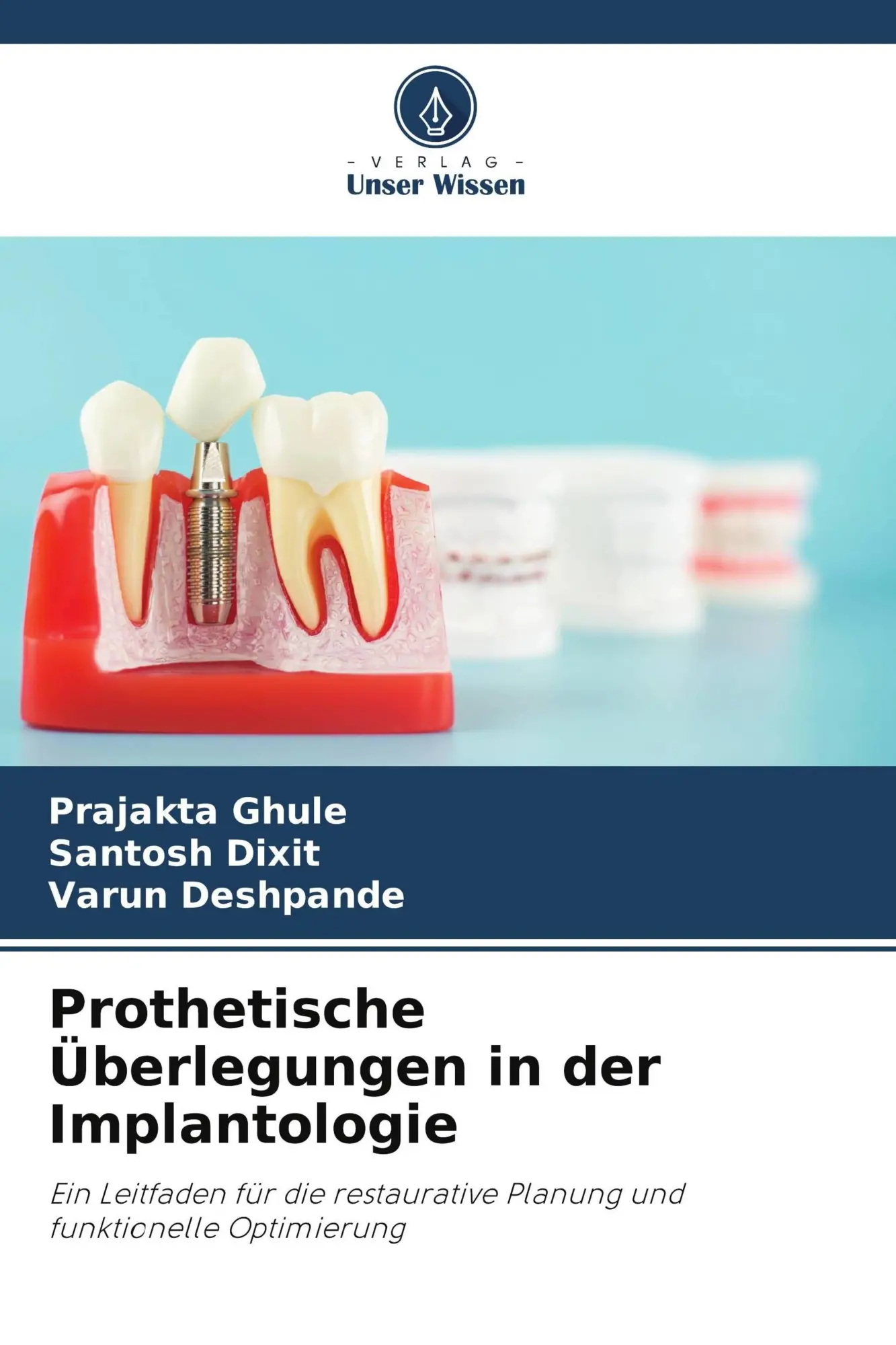 Cover: 9786209614477 | Prothetische Überlegungen in der Implantologie | Ghule (u. a.) | Buch