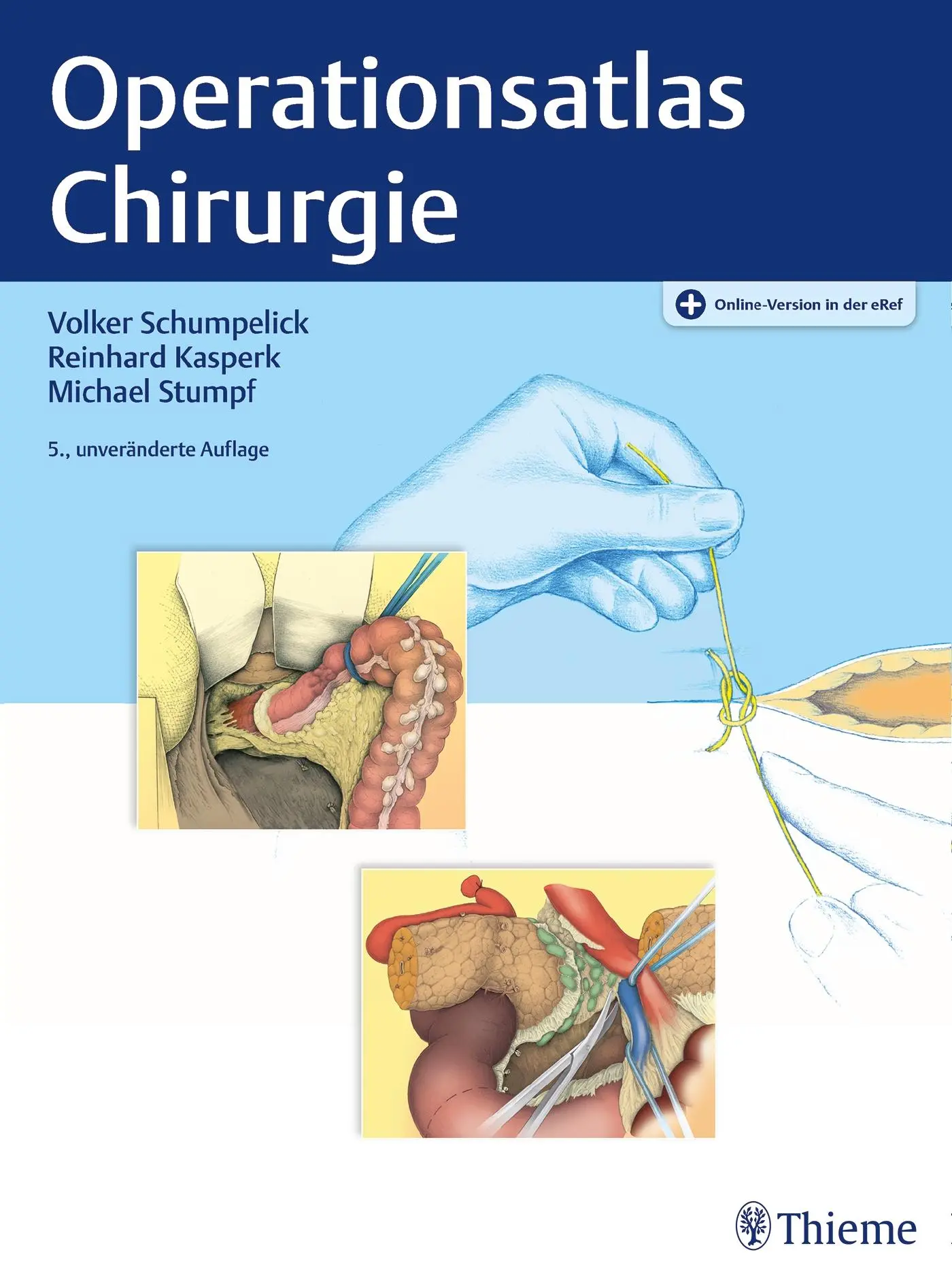 Cover: 9783132438477 | Operationsatlas Chirurgie | Volker Schumpelick (u. a.) | Bundle | 2020
