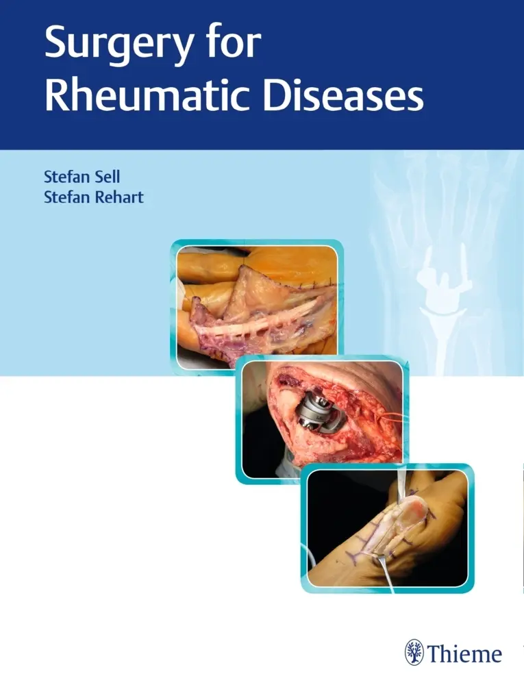 Cover: 9783132400078 | Surgery for Rheumatic Diseases | Stefan/Rehart, Stefan Sell | Buch
