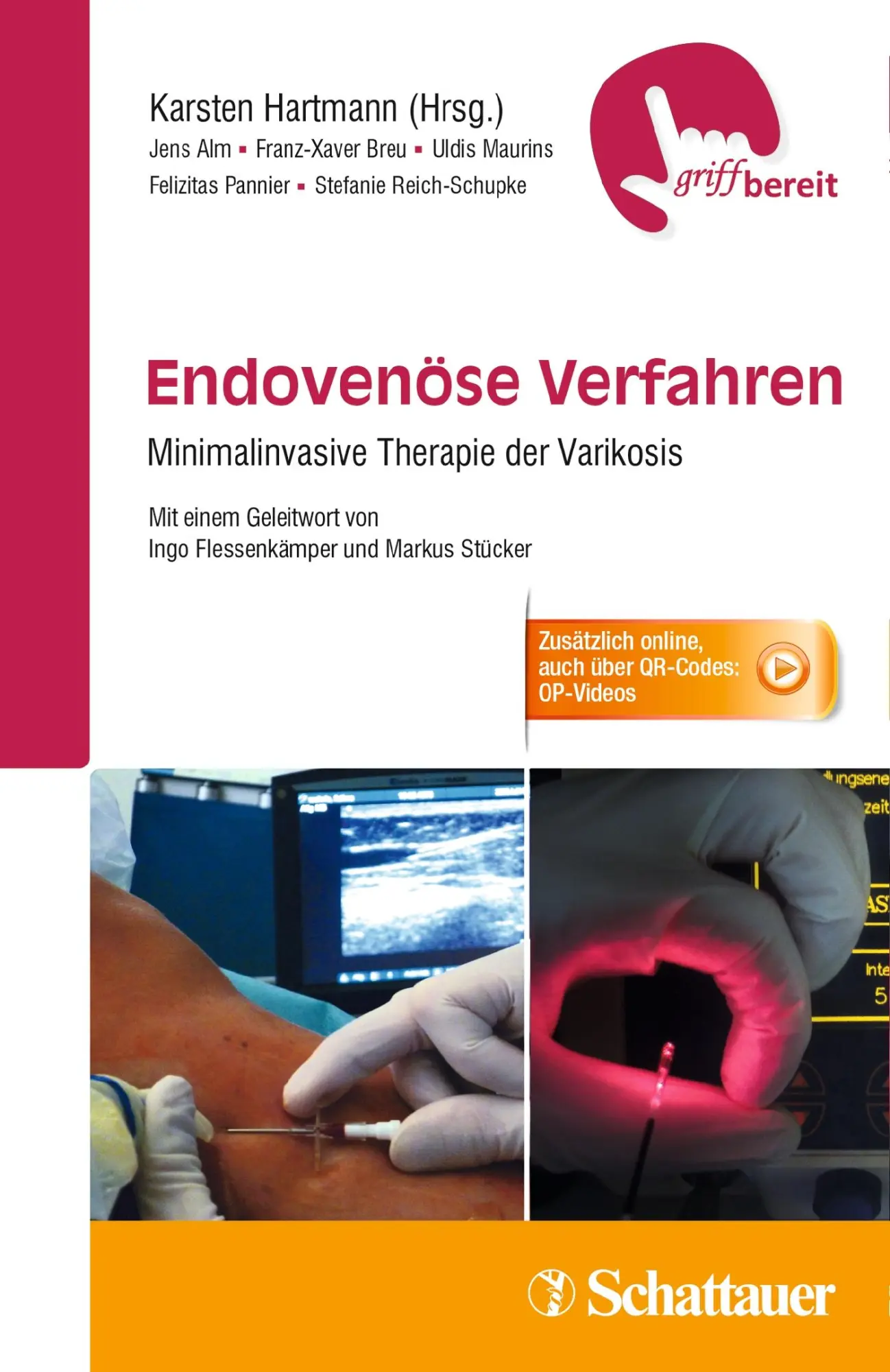 Cover: 9783794530878 | Endovenöse Verfahren | Jens Alm (u. a.) | Taschenbuch | 233 S. | 2015