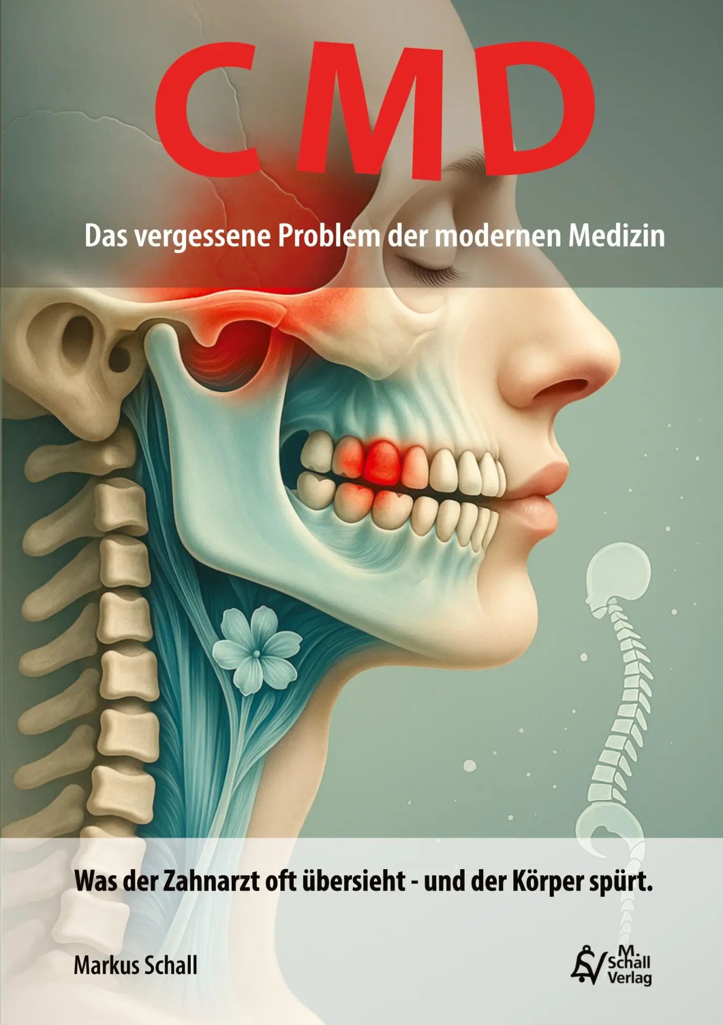 Cover: 9783819201578 | CMD - Das vergessene Problem der modernen Medizin | Markus Schall
