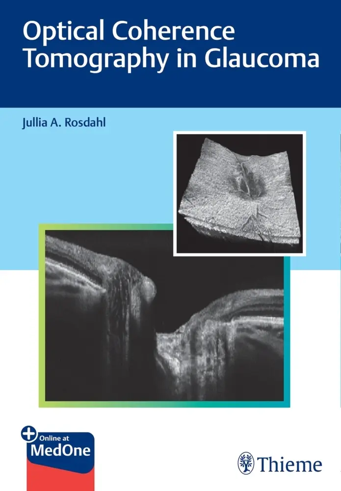 Cover: 9781684202478 | Optical Coherence Tomography in Glaucoma | Jullia Rosdahl | Bundle