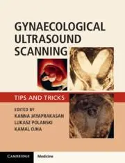 Cover: 9781316645178 | Gynaecological Ultrasound Scanning | Tips and Tricks | Taschenbuch
