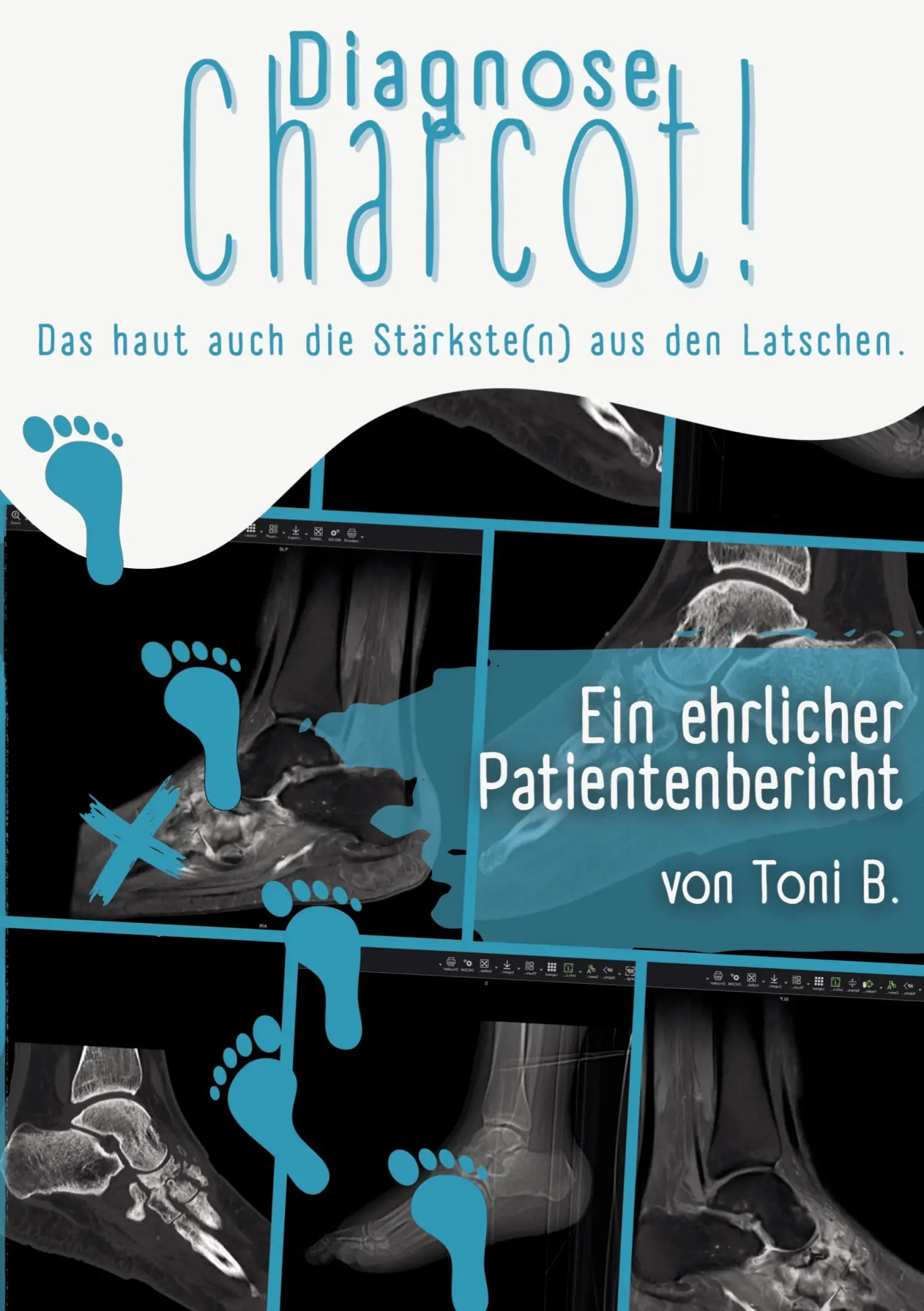 Cover: 9783695177578 | Diagnose Charcot! | Das haut auch die Stärkste(n) aus den Latschen.