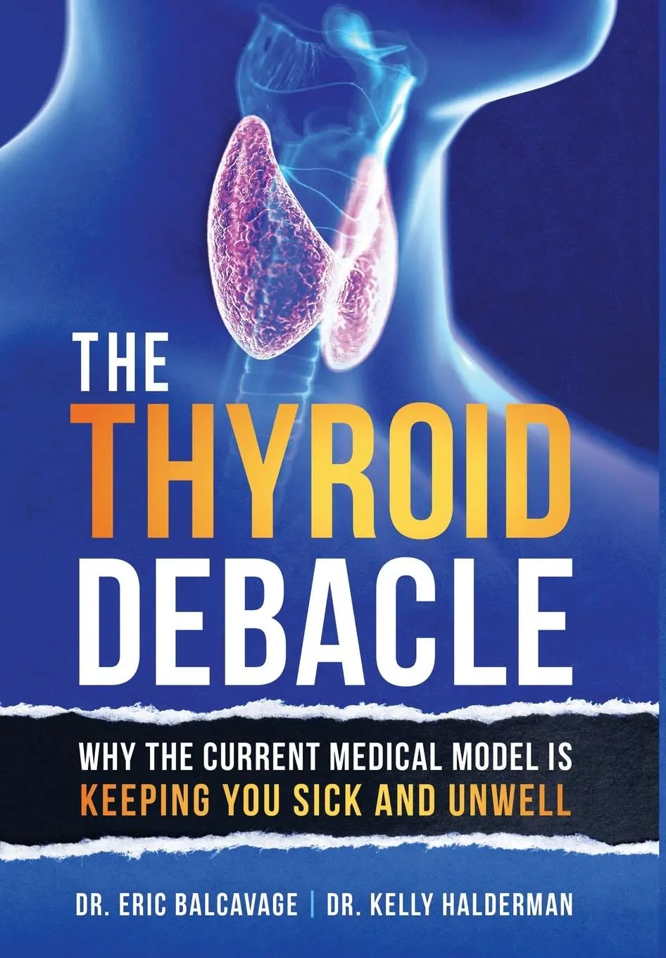 Cover: 9798765227978 | The Thyroid Debacle | Eric Balcavage (u. a.) | Buch | Gebunden | 2022