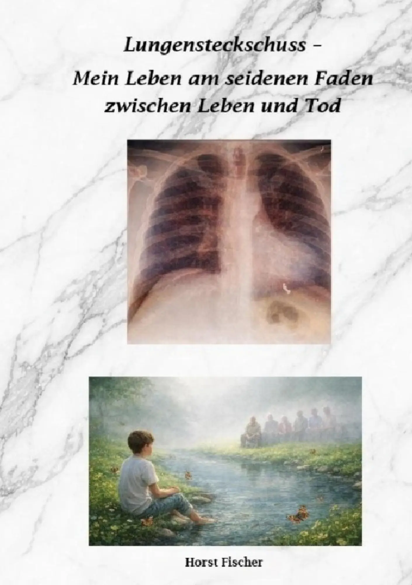 Cover: 9783696378578 | Lungensteckschuss - Mein Leben am seidenen Faden zwischen Leben und...