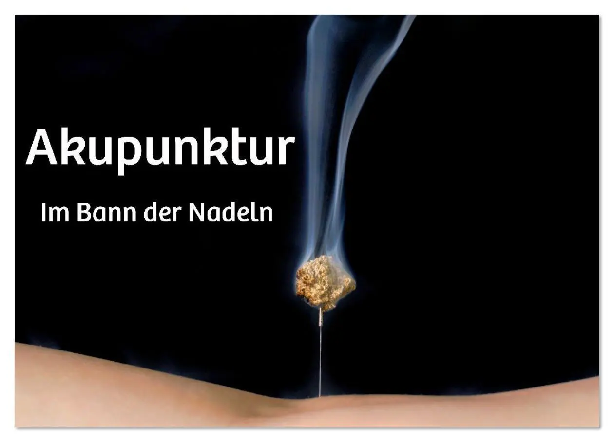 Cover: 9783516640779 | Akupunktur - Im Bann der Nadeln (Wandkalender 2026 DIN A4 quer),...