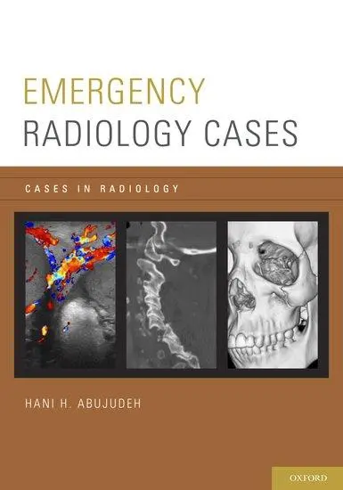 Cover: 9780199941179 | Emergency Radiology Cases | Hani H Abujudeh | Taschenbuch | Englisch