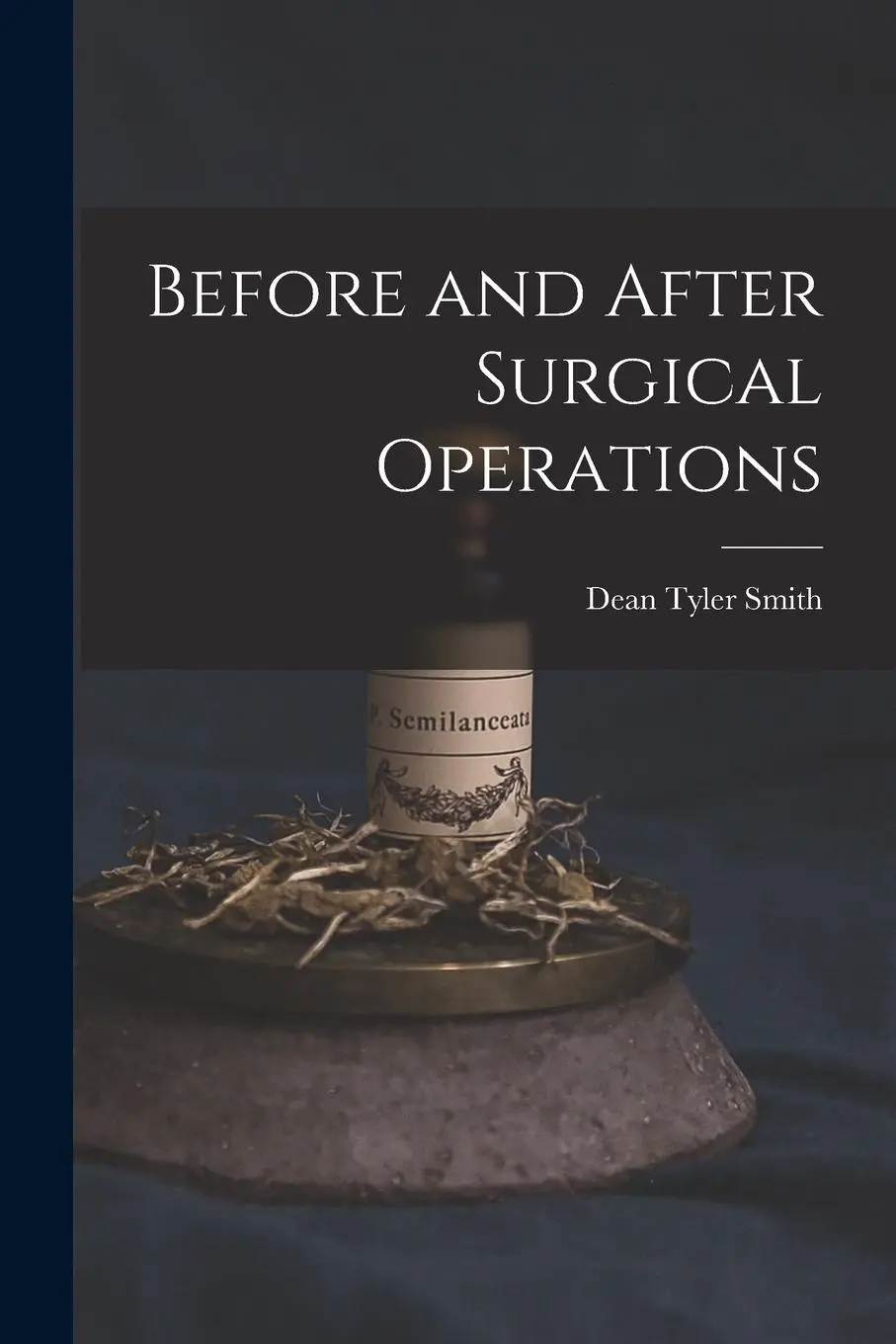 Cover: 9781018922379 | Before and After Surgical Operations | Dean Tyler Smith | Taschenbuch