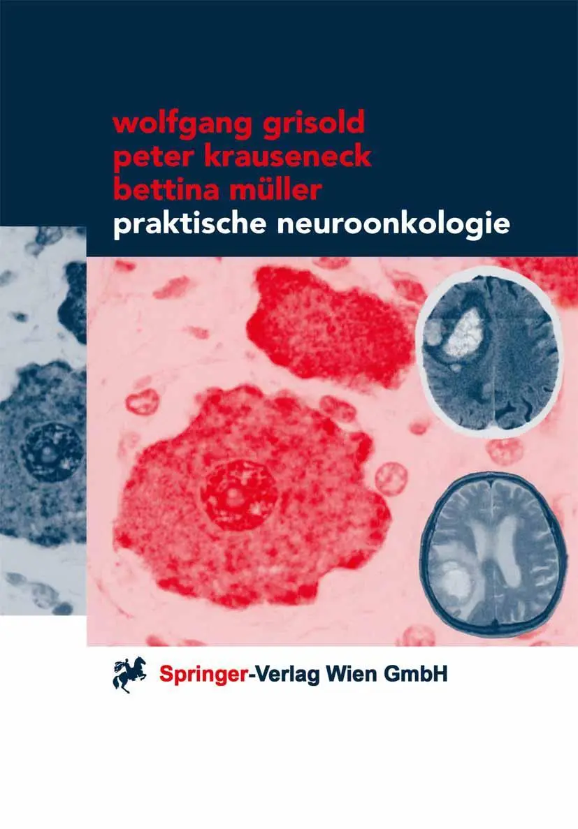 Cover: 9783211832479 | Praktische Neuroonkologie | Wolfgang Grisold (u. a.) | Taschenbuch