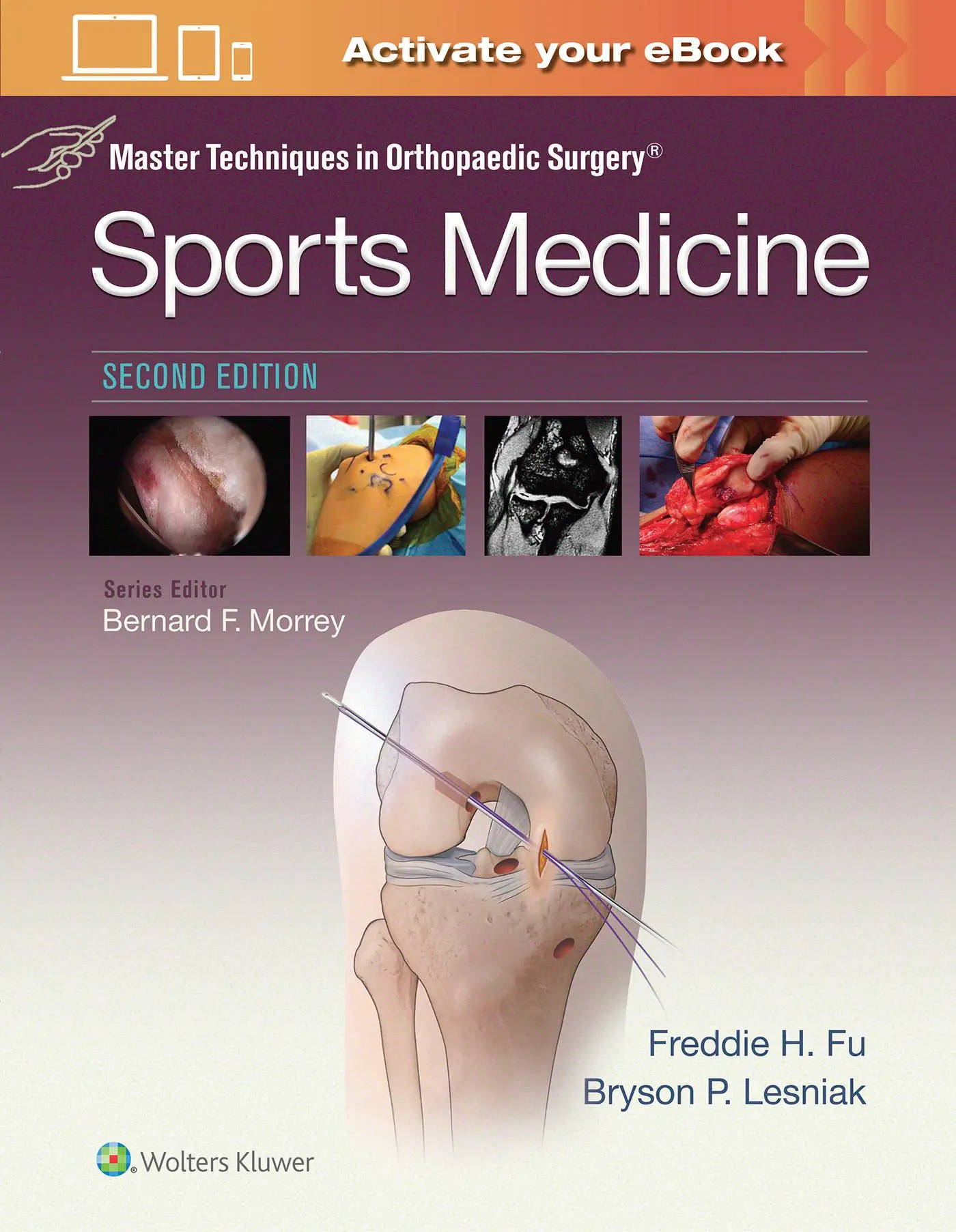 Cover: 9781496375179 | Master Techniques in Orthopaedic Surgery: Sports Medicine | Fu | Buch
