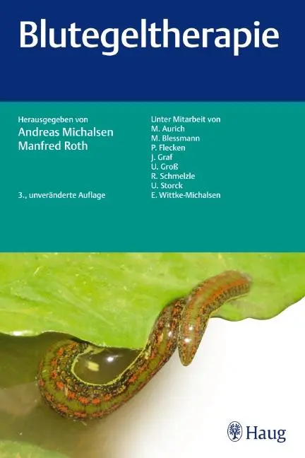 Cover: 9783830475279 | Blutegeltherapie | Andreas Michalsen (u. a.) | Taschenbuch | XIII