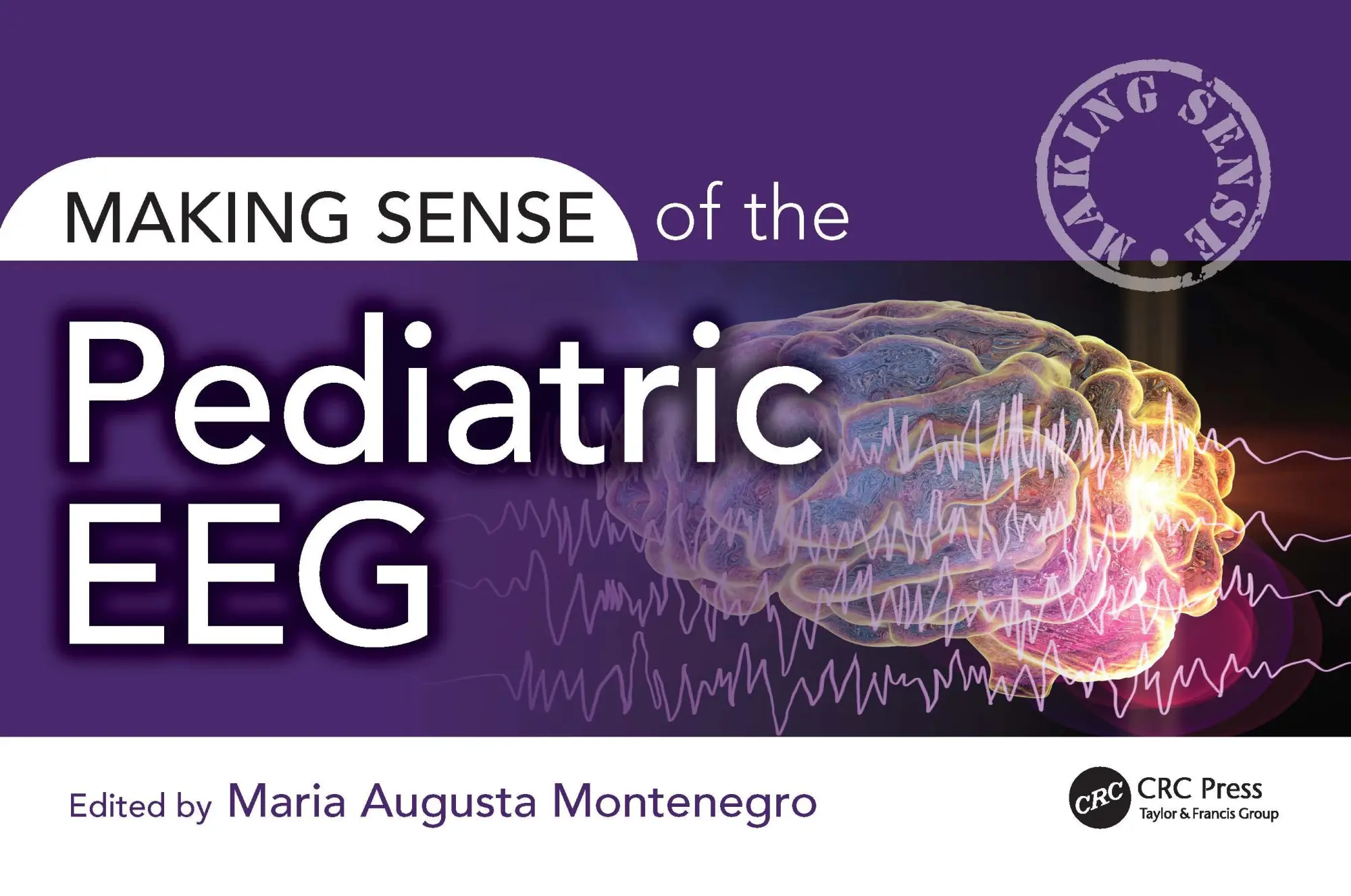 Cover: 9781032486079 | Making Sense of the Pediatric Eeg | Maria Montenegro | Taschenbuch