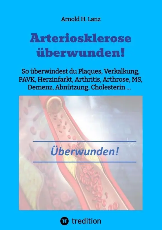 Cover: 9783384006479 | Arteriosklerose überwunden! | Arnold H. Lanz | Taschenbuch | Paperback