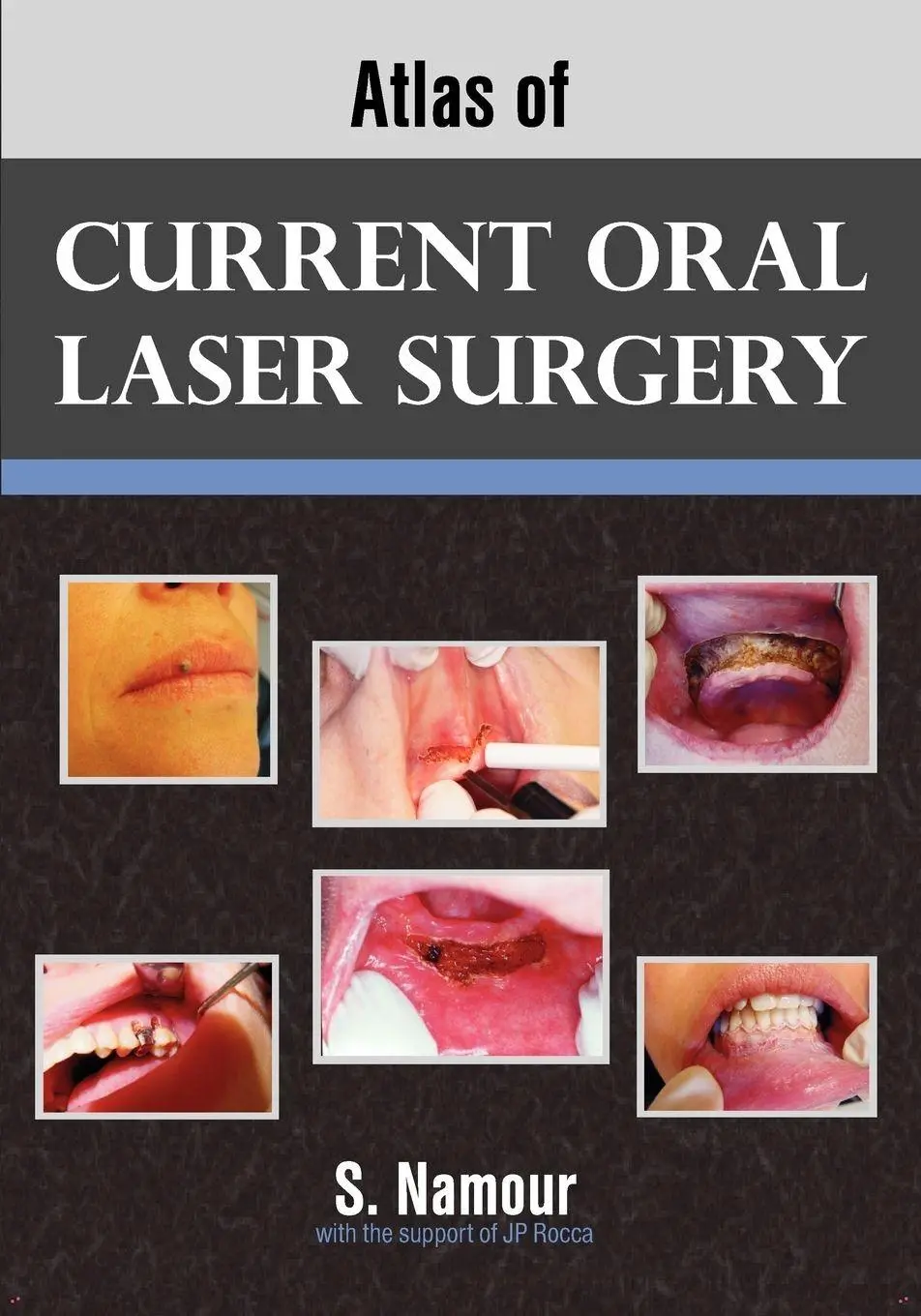 Cover: 9781612330280 | Atlas of Current Oral Laser Surgery | S. Namour | Taschenbuch | 2011