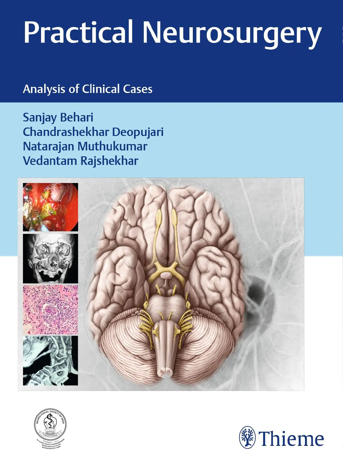 Cover: 9789385062780 | Practical Neurosurgery | Analysis of Clinical Cases | Behari (u. a.)
