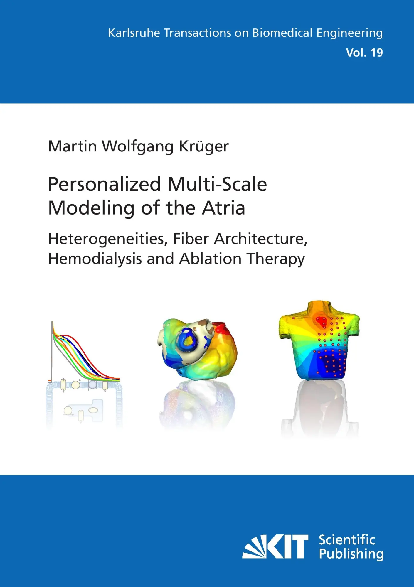 Personalized Multi-Scale Modeling of the Atria: Heterogeneities, Fiber Architecture, Hemodialysis and Ablation Therapy - Neuware