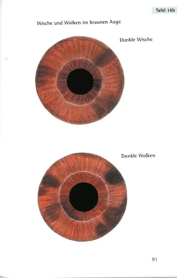 Bild: 9783946321781 | Repertorium der Irisdiagnose | Joachim Broy | Buch | 638 S. | Deutsch