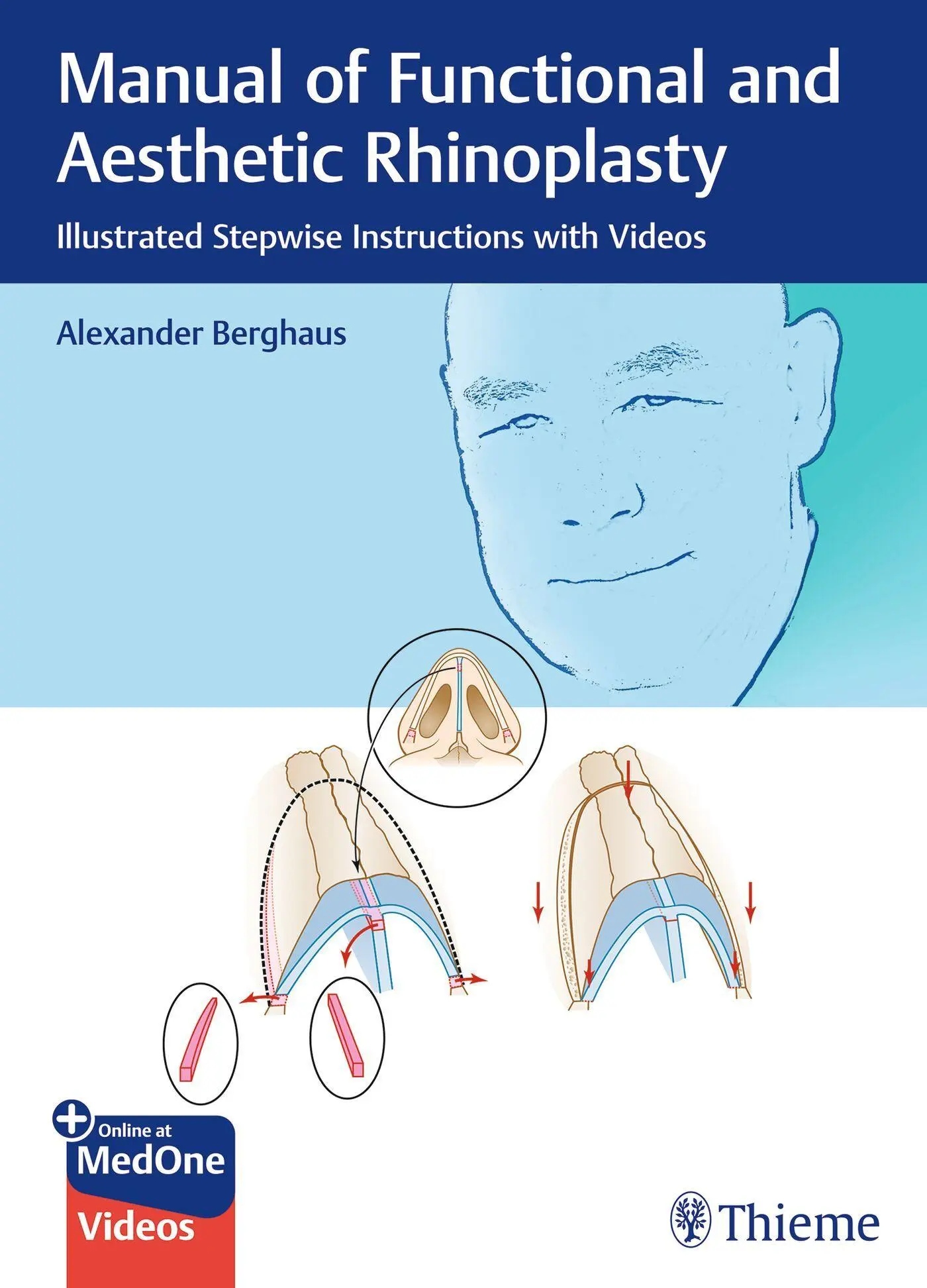 Cover: 9783132412781 | Manual of Functional and Aesthetic Rhinoplasty | Alexander Berghaus