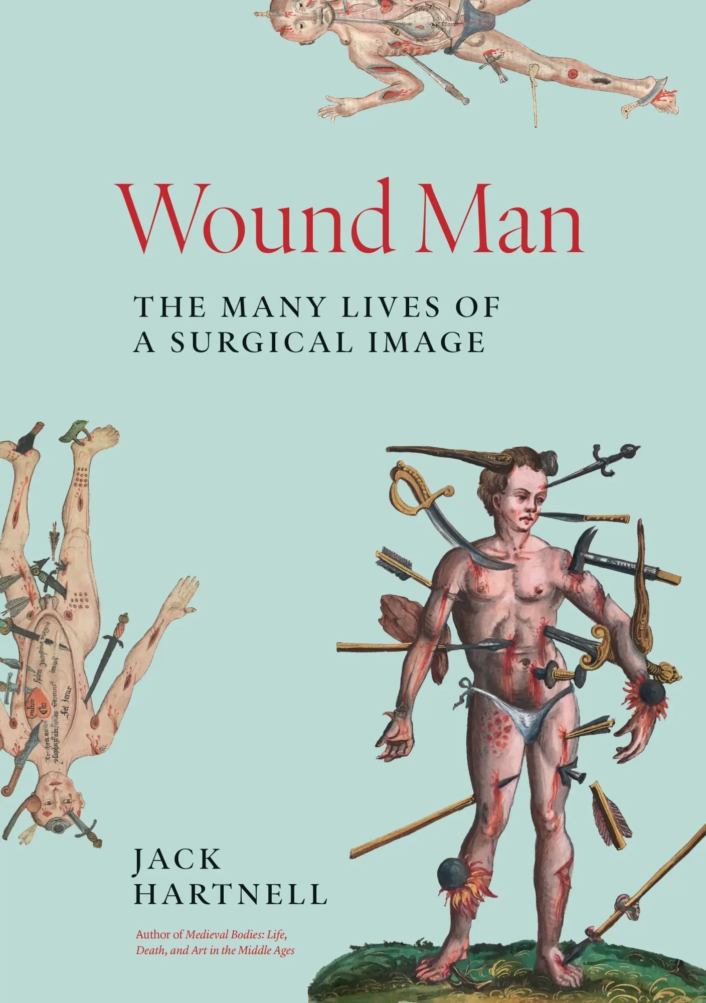 Cover: 9780691243481 | Wound Man | The Many Lives of a Surgical Image | Jack Hartnell | Buch