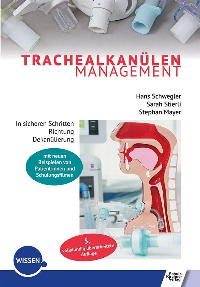 Cover: 9783824813681 | Trachealkanülenmanagement | Hans Schwegler (u. a.) | Taschenbuch
