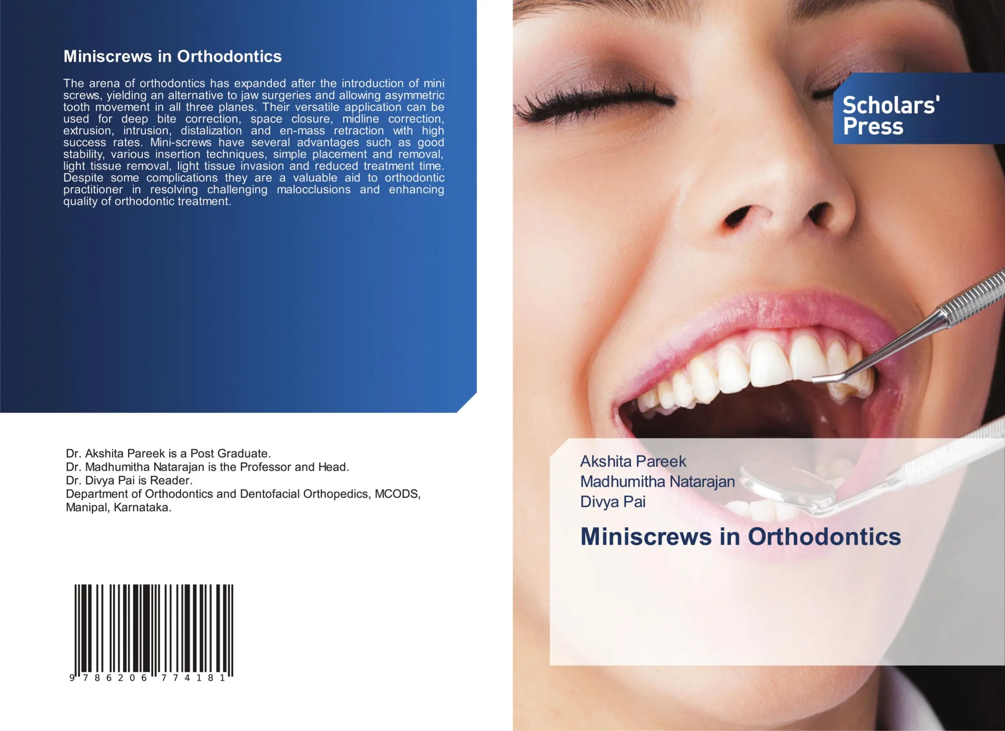 Cover: 9786206774181 | Miniscrews in Orthodontics | Akshita Pareek (u. a.) | Taschenbuch
