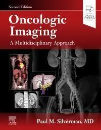 Cover: 9780323695381 | Oncologic Imaging: A Multidisciplinary Approach | Paul M. Silverman