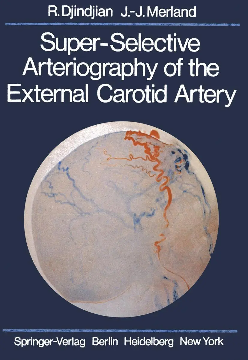 Cover: 9783642665981 | Super-Selective Arteriography of the External Carotid Artery | Buch