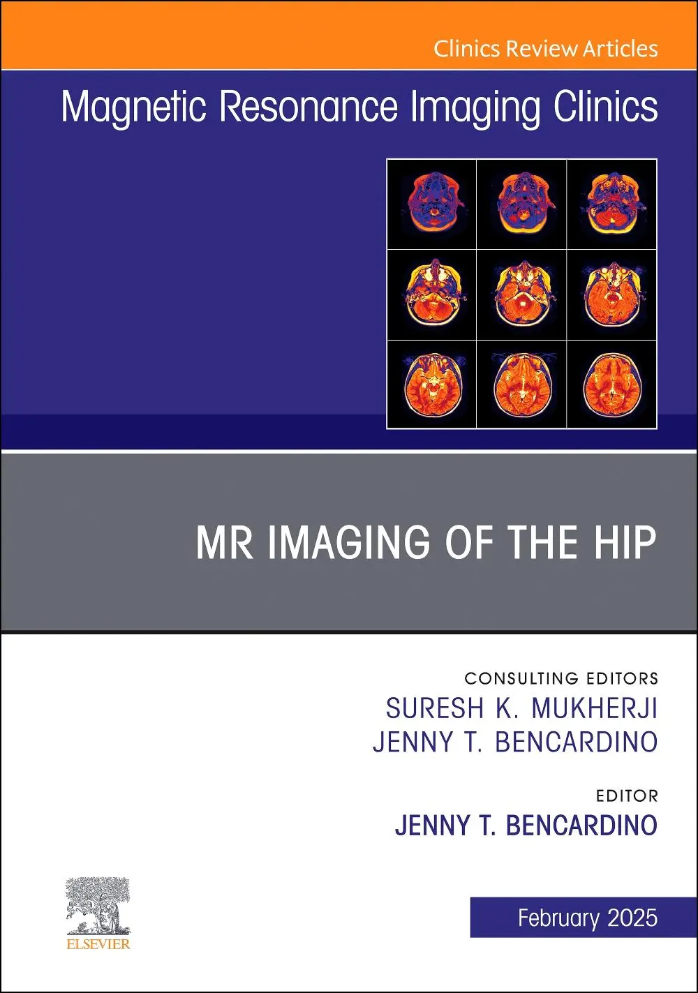 Cover: 9780443296581 | MR Imaging of the Hip, an Issue of Magnetic Resonance Imaging...