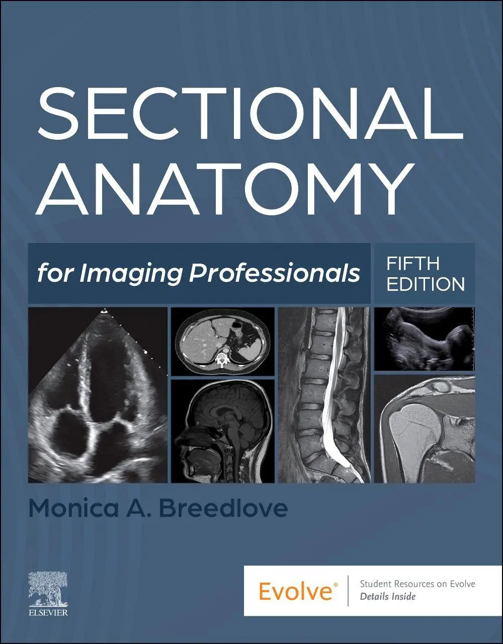 Cover: 9780323827881 | Sectional Anatomy for Imaging Professionals | Monica Breedlove | Buch