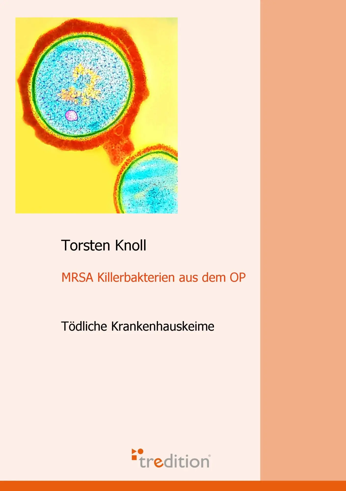 Cover: 9783868500882 | MRSA Killerbakterien aus dem OP | Tödliche Krankenhauskeime | Knoll