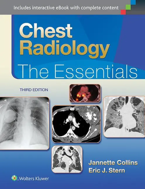 Cover: 9781451144482 | Chest Radiology: The Essentials | Janette Collins (u. a.) | Buch