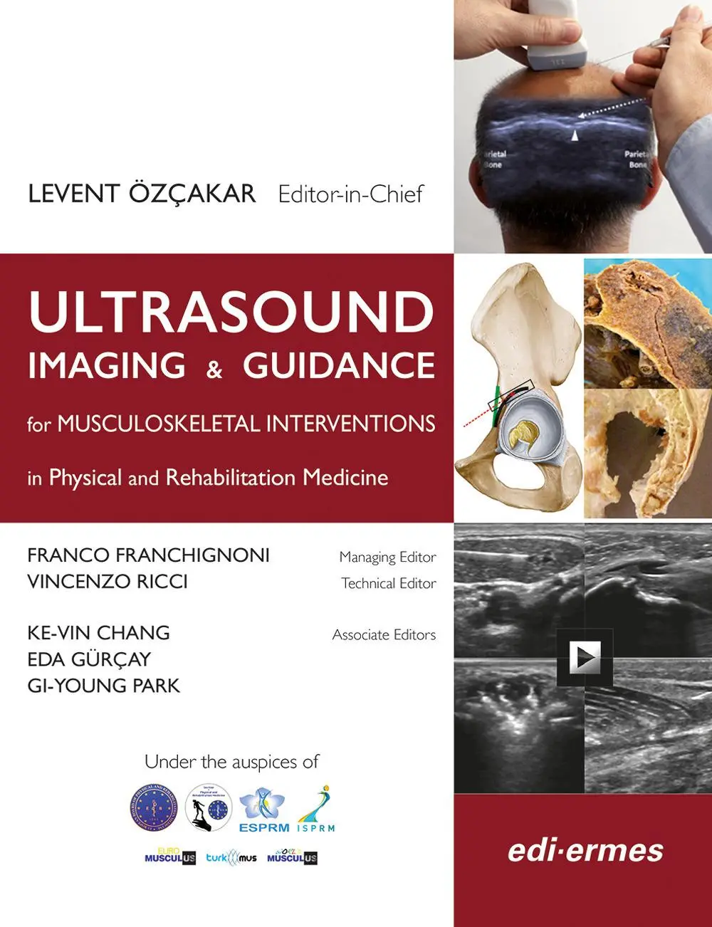 Cover: 9788870516982 | Ultrasound Imaging &amp; Guidance for Musculoskeletal Interventions in...