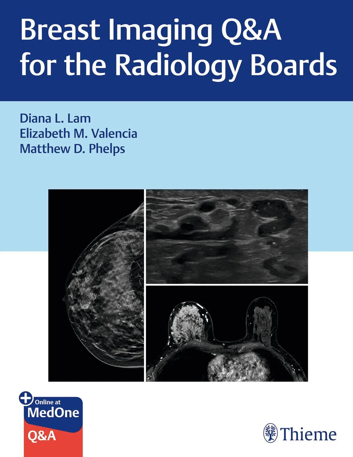 Breast Imaging Q&amp,A for the Radiology Boards