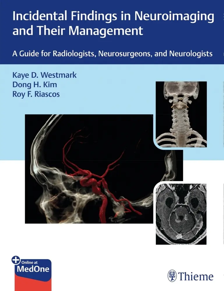 Cover: 9781626238282 | Incidental Findings in Neuroimaging and Their Management | Bundle