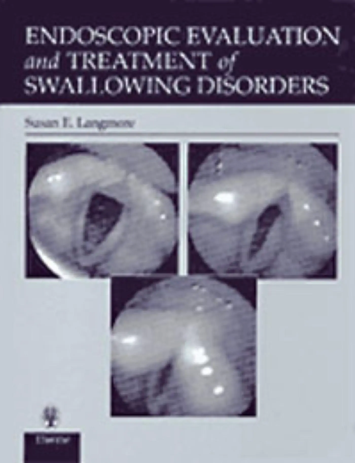 Cover: 9780865778382 | Endoscopic Evaluation and Treatment of Swallowing Disorders | Langmore