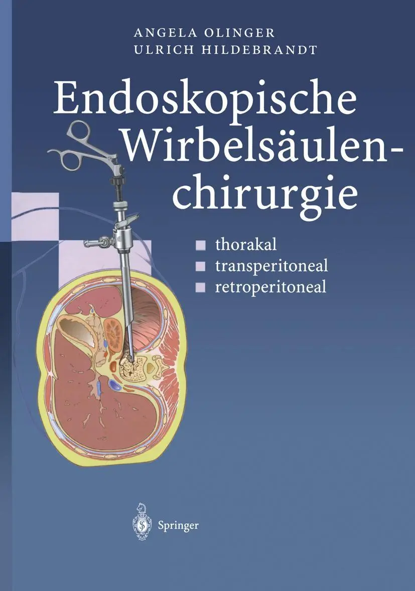 Cover: 9783642630583 | Endoskopische Wirbelsäulenchirurgie | Angela Olinger (u. a.) | Buch