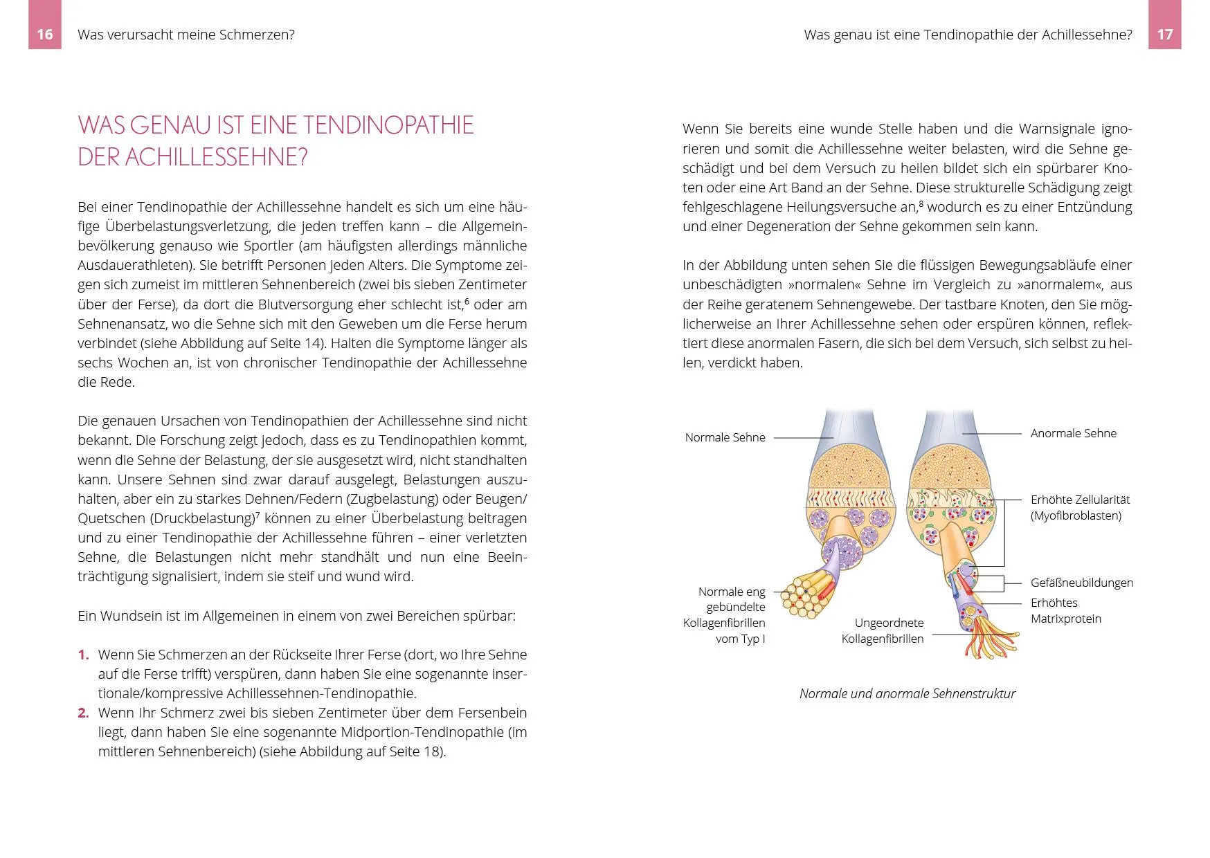 Bild: 9783742313683 | Beschwerden der Achillessehne selbst behandeln | Paula Clayton | Buch