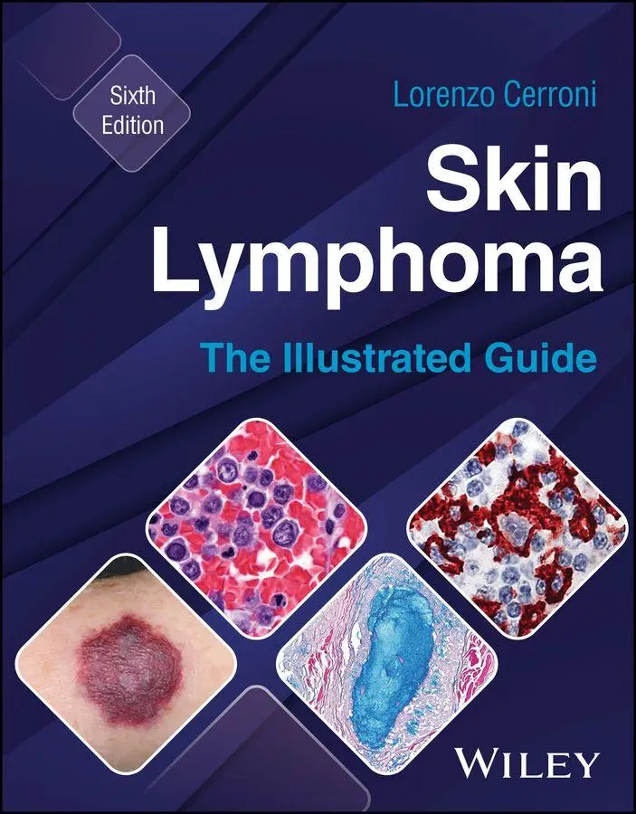 Cover: 9781394235483 | Skin Lymphoma | The Illustrated Guide | Lorenzo Cerroni | Buch | 2026