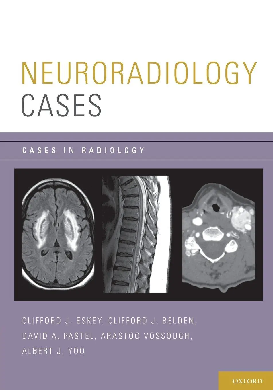 Cover: 9780199735983 | Neuroradiology Cases | Clifford J. Eskey (u. a.) | Taschenbuch | 2012