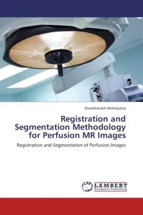 Cover: 9783846526583 | Registration and Segmentation Methodology for Perfusion MR Images