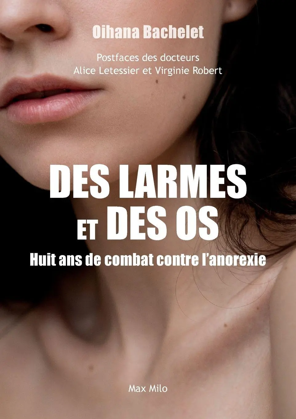Cover: 9782315026883 | Des larmes et des os | Huit ans de combat contre l'anorexie | Bachelet